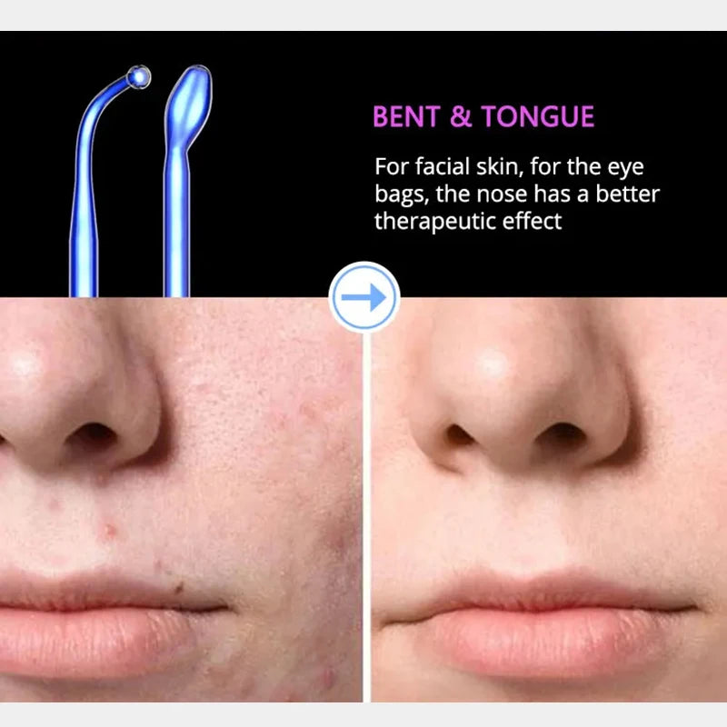 Revitalize Your Skin with the Blue 6-In-1 High Frequency Facial Machine - Anti-Aging, Acne Treatment, and Hair Therapy Tool with Neon & Argon Wands