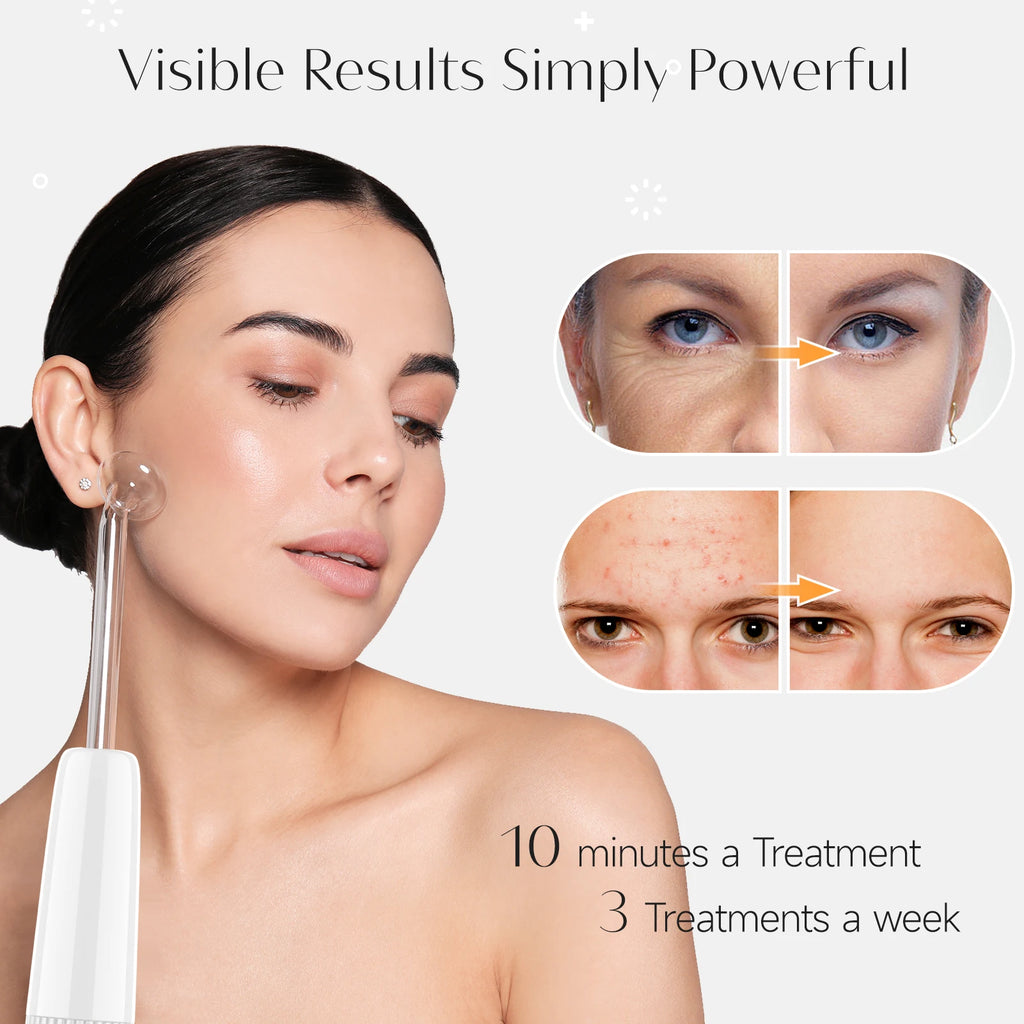 Revitalize Your Skin with the Blue 6-In-1 High Frequency Facial Machine - Anti-Aging, Acne Treatment, and Hair Therapy Tool with Neon & Argon Wands