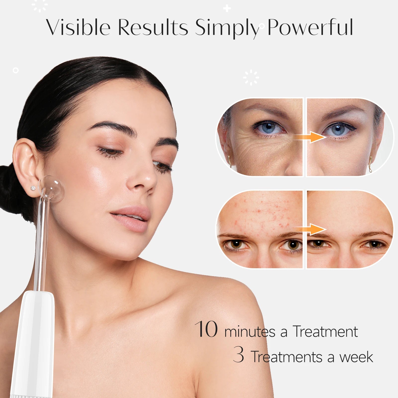 Revitalize Your Skin with the Blue 6-In-1 High Frequency Facial Machine - Anti-Aging, Acne Treatment, and Hair Therapy Tool with Neon & Argon Wands
